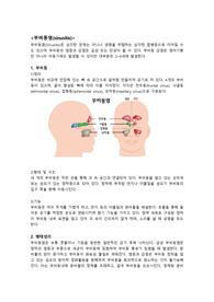아동간호학 _ 질병보고서 _ 부비동염