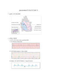 인공심박조율기(pacemaker)