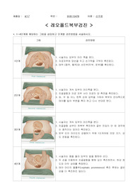 레오폴드, 태아심음청진