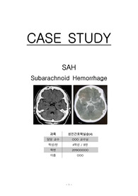 지주막하출혈(SAH) 케이스 스터디