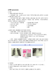 폐렴, pneumonia 문헌고찰
