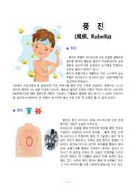 풍진