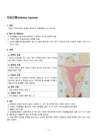 여성건강간호학 분담과제 자궁근종 내용입니다.