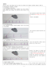 심전도 개념 및 사진과 발표대본까지 있는 자료입니다.