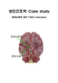 [성인간호학 A+] 중대뇌동맥 경색 Case Study 간호과정 3가지