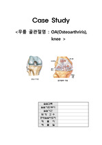 무릎 골관절염 cace study