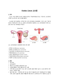 난소암 문헌고찰