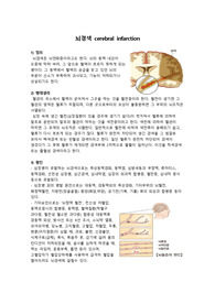 뇌경색 문헌고찰