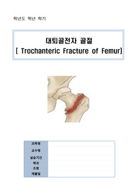 골절 케이스 스터디 간호진단 3개(질병과 관련된 낙상의 위험 등)