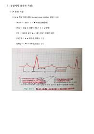 성인간호학 순환계 Part [부정맥 (Dysrhythmia, Arrhythmia)] / 종류와 특징 (동성 리듬, 이소성 박동, 빈맥성,  서맥성) / 치료와 간호( Class / 항부정맥제 / 응급약물 / 미주신경 자극법 / 제세동 (Defibrillation) /  심장율동전환술 /