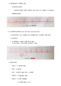 성인간호학 순환계 Part [부정맥 (Dysrhythmia, Arrhythmia)] / 종류와 특징 (동성 리듬, 이소성 박동, 빈맥성,  서맥성) / 치료와 간호( Class / 항부정맥제 / 응급약물 / 미주신경 자극법 / 제세동 (Defibrillation) /  심장율동전환술 /