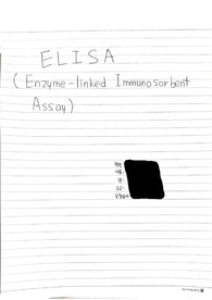 [세포공학실험] ELISA(Enzyme-linked Immunosorbent Assay) 예비보고서 A0