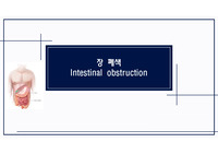 장폐색intestinal obstruction , ileus