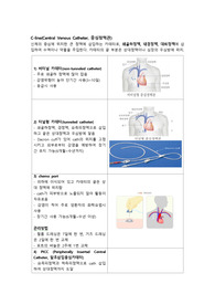 PICC 간단한 정리