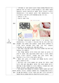 아동간호학 소아수족구병 문헌고찰