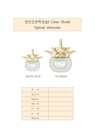 성인간호학 실습 CASE STUDY 자료입니다. 척추관 협착증. 수술부위와 관련된 통증, 침습적인 처치와 관련된 감염위험성, 약물투여와 관련된 오심,  장운동 저하와 관련된 변비위험성 등 6개