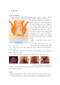 학점 a+받은 치질(치핵) 케이스입니다.