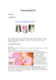 학점a+받은 폐렴 케이스입니다. 진단4개와 과정4개의 기승전결 깔끔한 과정입니다