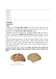 노인간호학실습 알츠하이머 케이스스터디 간호진단, 과정3개