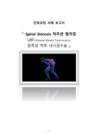 영혼을갈아넣은 간호학과 A+ 성인간호학실습CASE, 정형외과, 수술실, Spinal Stenosis, 척추관 협착증, 문헌고찰, 방사선검사, UBF양측성 척추 내시경수술, 약물치료, 간호진단3개, 간호과정3개(수술과 관련된 급성 통증, 유치도뇨관 삽입과 관련된 감염 위험성, 수술에 대한 지식부족과 관련된 불안), UBF수술과정CASE