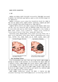 뇌졸중 환자 운동물리치료