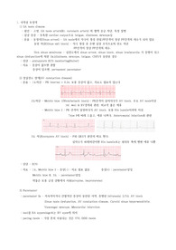 부정맥의 종류