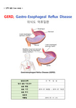 [성인간호학] GERD, 위식도역류질환 Case study(영양부족, 수면장애)