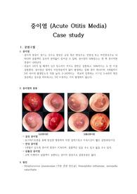 [아동] 중이염(Acute Otitis Media) - 간호진단3개, 간호과정1개 (고체온, 급성통증, 지식부족)