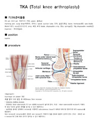 zimmer persona 인공관절치환술 TKRA 수술과정 정형외과수술 total knee arthroplasty