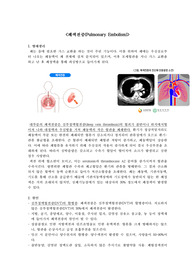 폐색전증 문헌고찰