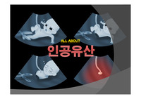 [현대사회와 윤리] 인공유산