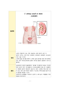 성인간호학실습_간호실습 문헌고찰_요로결석 문헌고찰