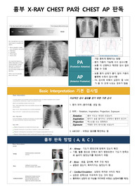 흉부엑스레이 판독에 관하여