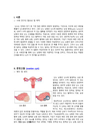 [A+] 난소낭종 문헌고찰 (ovarian cyst) 사례연구 필요성, 목적, 병태생리, 원인, 증상, 치료 및 간호