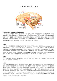 베르니케뇌증 (mental change) case study