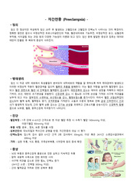 자간전증 (Preeclampsia) 문헌고찰