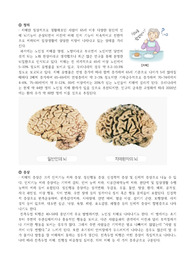 A+노인간호 치매 문헌고찰+진단,과정2개