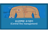 중심정맥관 유지관리(Central line management)