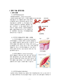 성인간호학 NSICU 실습 뇌동맥류/지주막하출혈 case study A