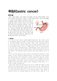 위암/문헌고찰/케이스스터디/간호진단/간호과정