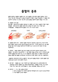 출혈의 종류