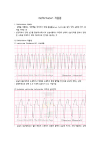 defibrillation 적응증 요약정리