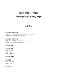 인공관절치환술(arthroplasty)