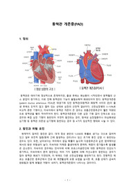 아동간호_동맥관 개존증