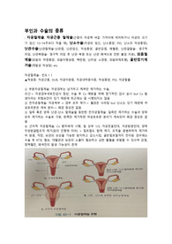 부인과 수술의 종류
