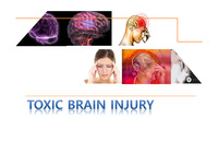 독성 뇌손상 Toxic Brain Injury - 독성 물질에 의한 뇌손상 관련 소개입니다.