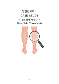 성인간호학실습 심부정맥혈전증(DVT) CASE STUDY
