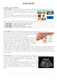 성인간호학- 담석증 문헌고찰