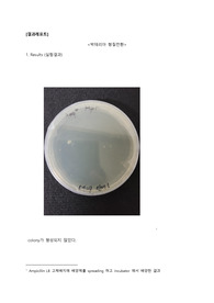 박테리아 형질 전환 결과 보고서