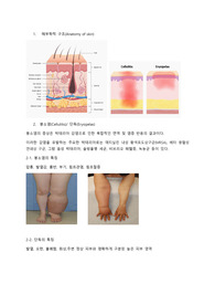 붕소염(Cellulitis) 단독(Erysipelas)